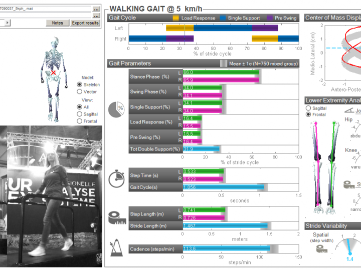 New Product – 3D Clinical Gait